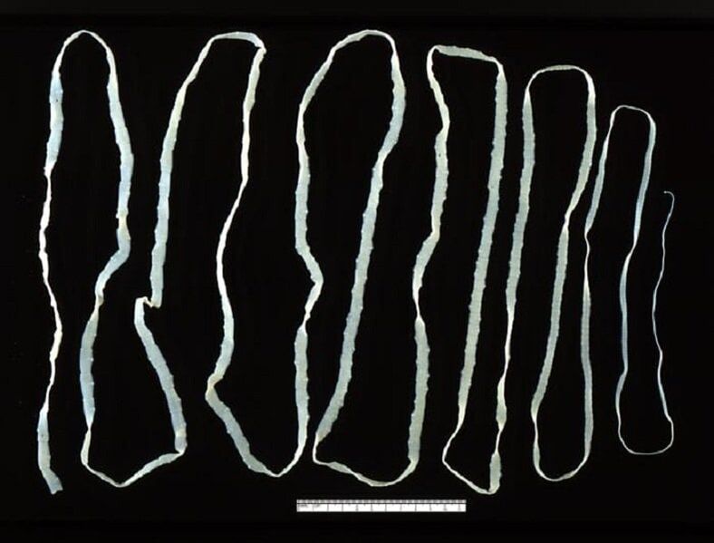 Ténia extrait de l'intestin humain