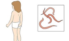 Symptômes de la présence de parasites dans le corps humain