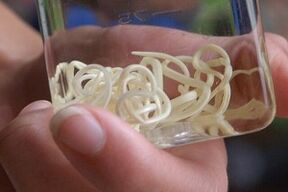 Parasites du corps humain