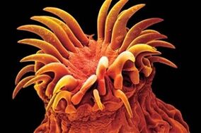 Parasites trématodes chez l'homme