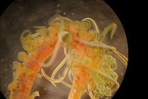 parasites nématoïdes dans le corps humain