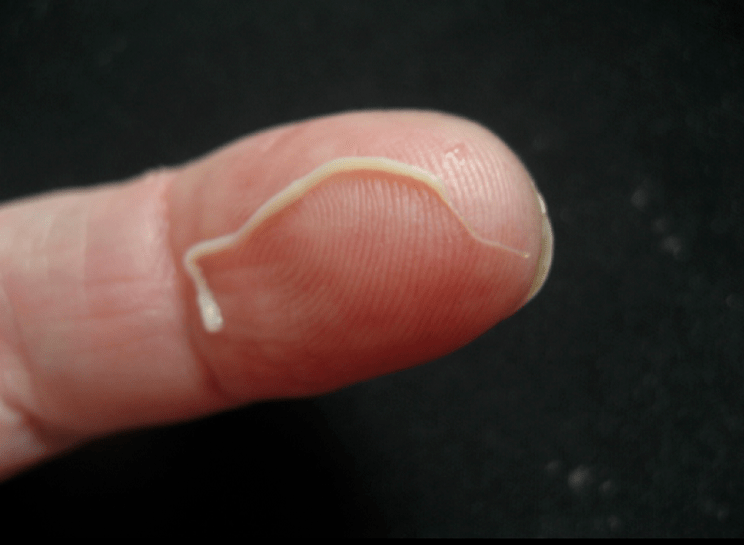 Parasite des ascaris du corps humain