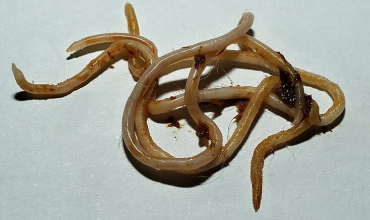 Toxocara du corps humain